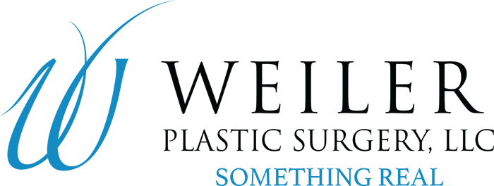 Weiler plastic surgery