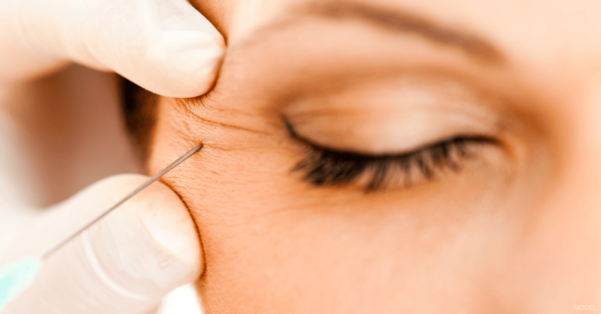 Eye Injectables Dermal Fillers