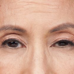 Susan - After