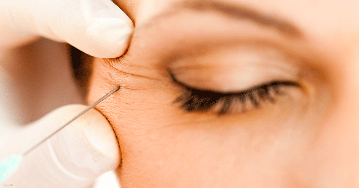 Woman receiving filler injections. 