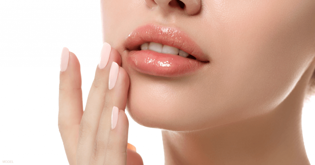 A woman's lips after receiving lip filler.