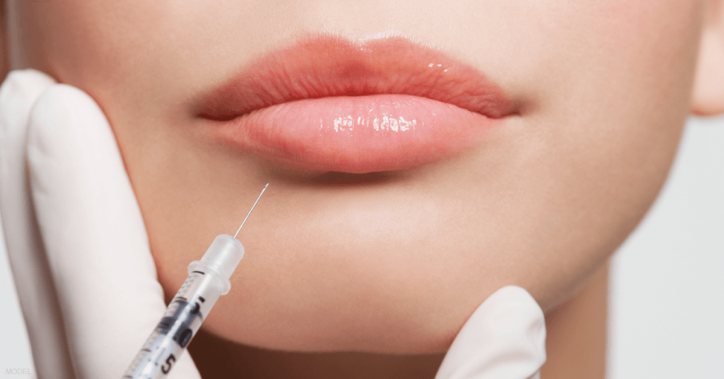 A woman receives an injection of dermal fillers in her lips.