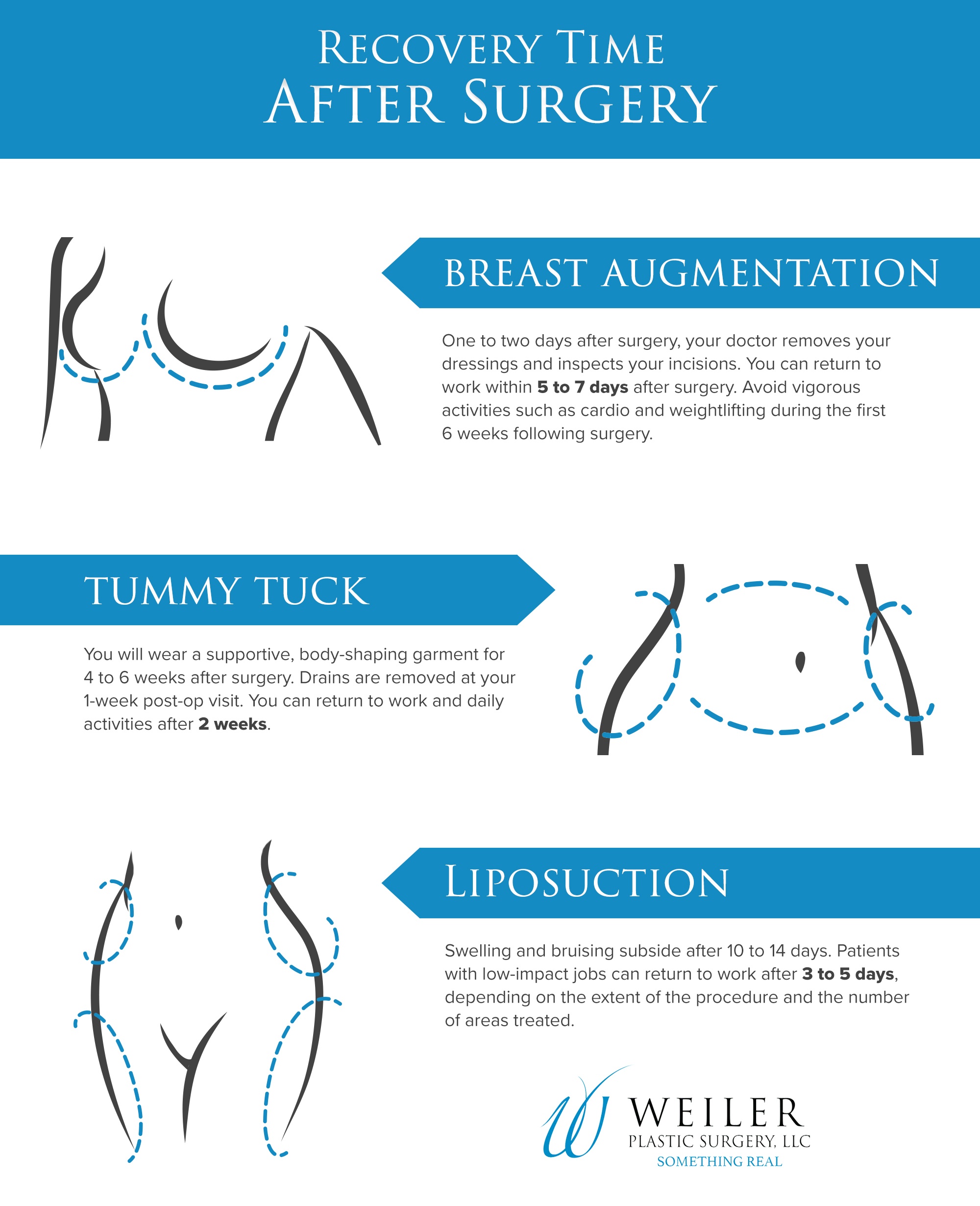 day by day tummy tuck recovery timeline