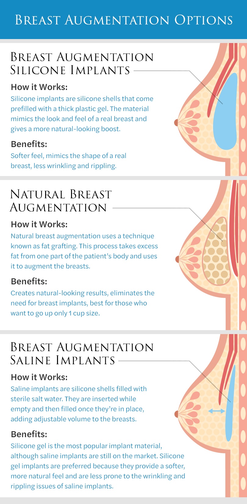 Which Breast Implant Placement Gives a Natural Appearance?