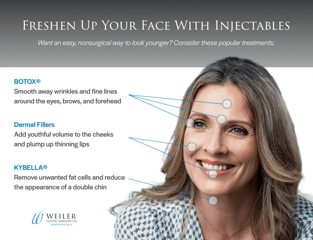 Infographic for areas of the face that can be treated by injectables