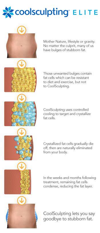 Coolsculpting Elite process