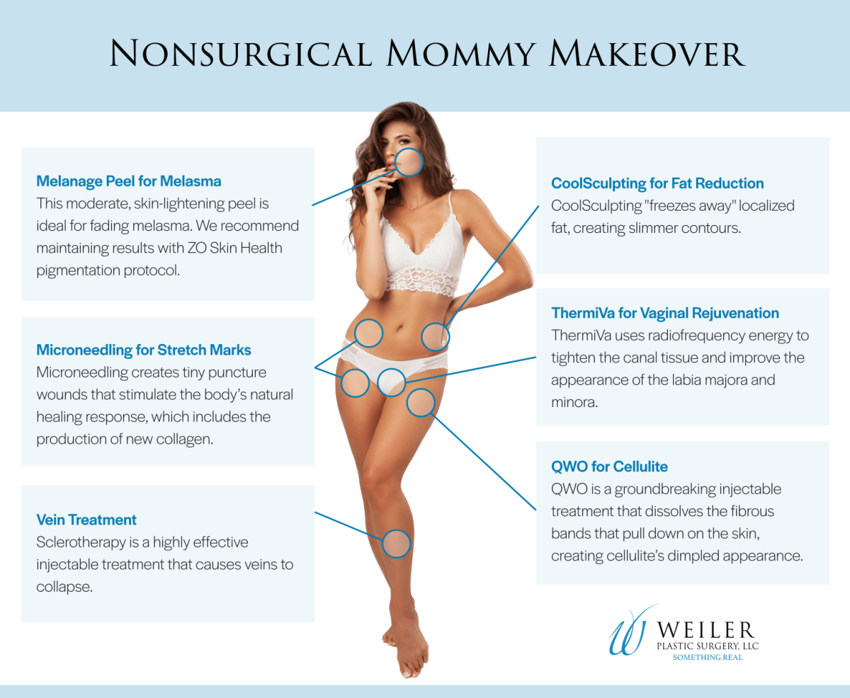 Nonsurgical Mommy Makeover infographic