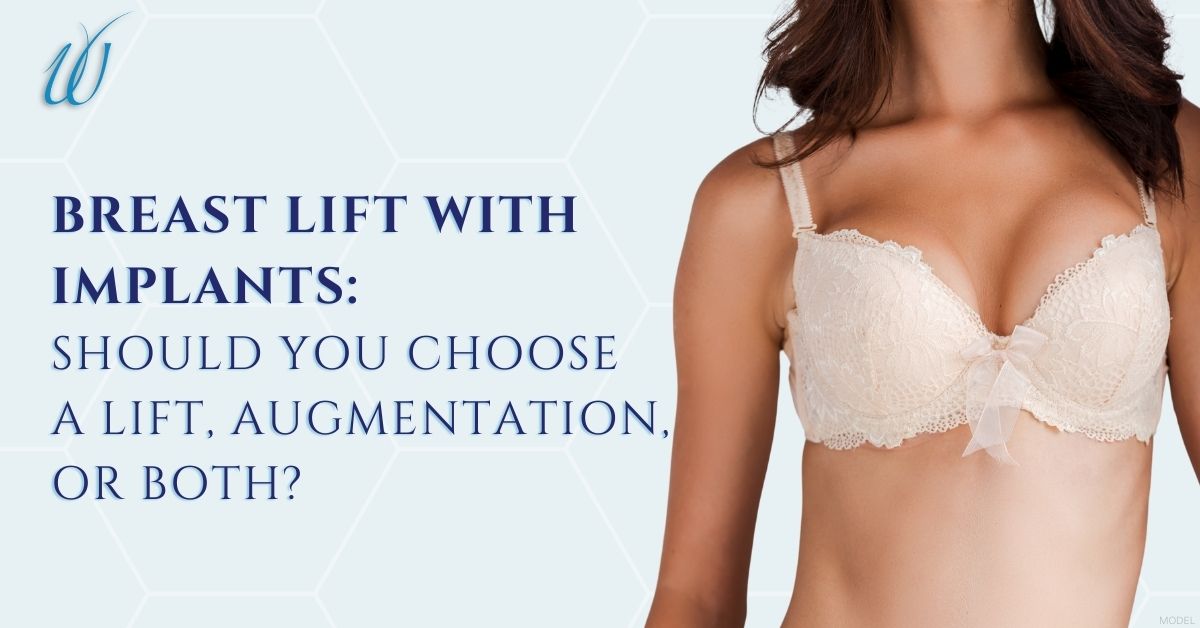 Woman enjoying her breast lift with implants results (model)