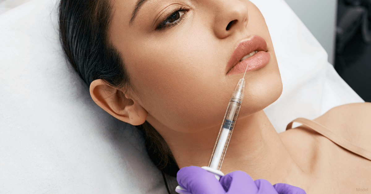 A middle aged woman receiving lip filler treatment (model)