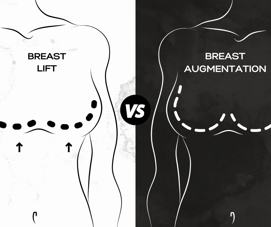 Breast lift versus breast augmentation infographic