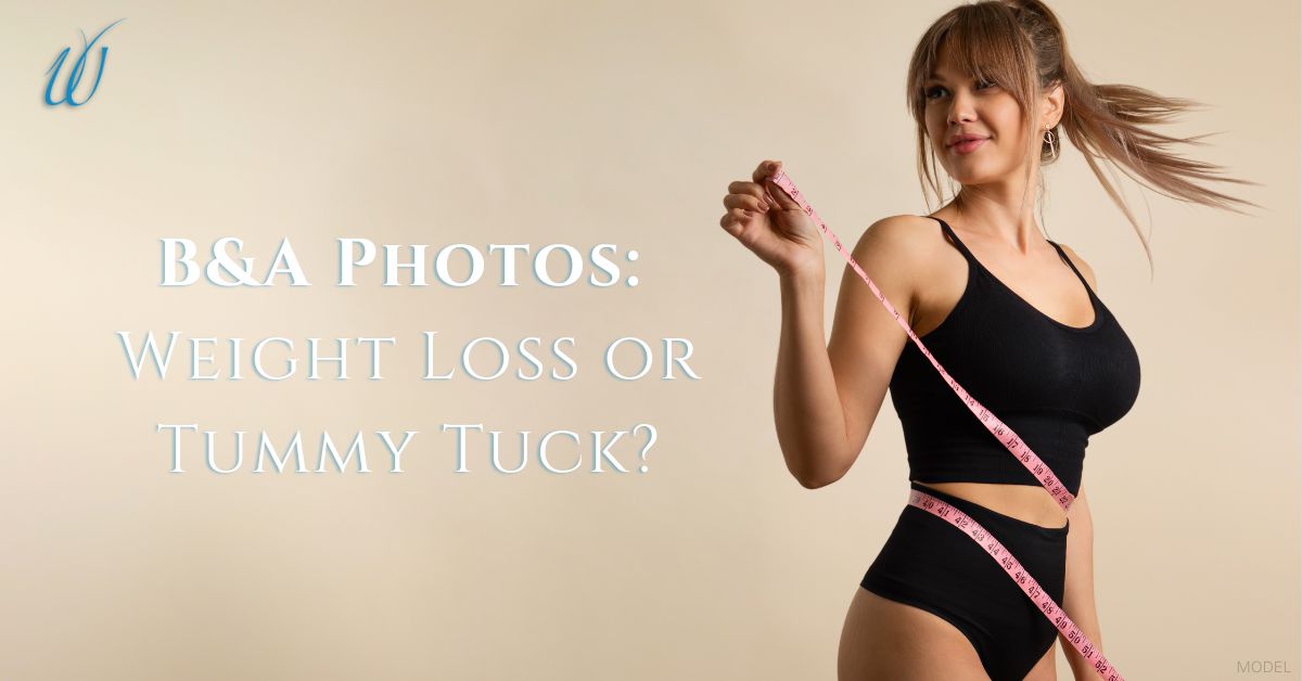 model in black tank top and underwear with measuring tape wrapped around her body