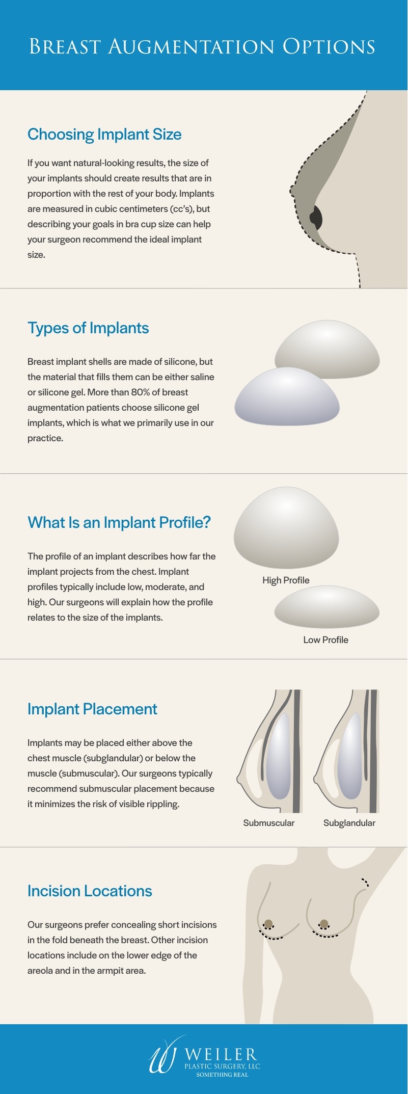 Breast Implant Options Instagraphic