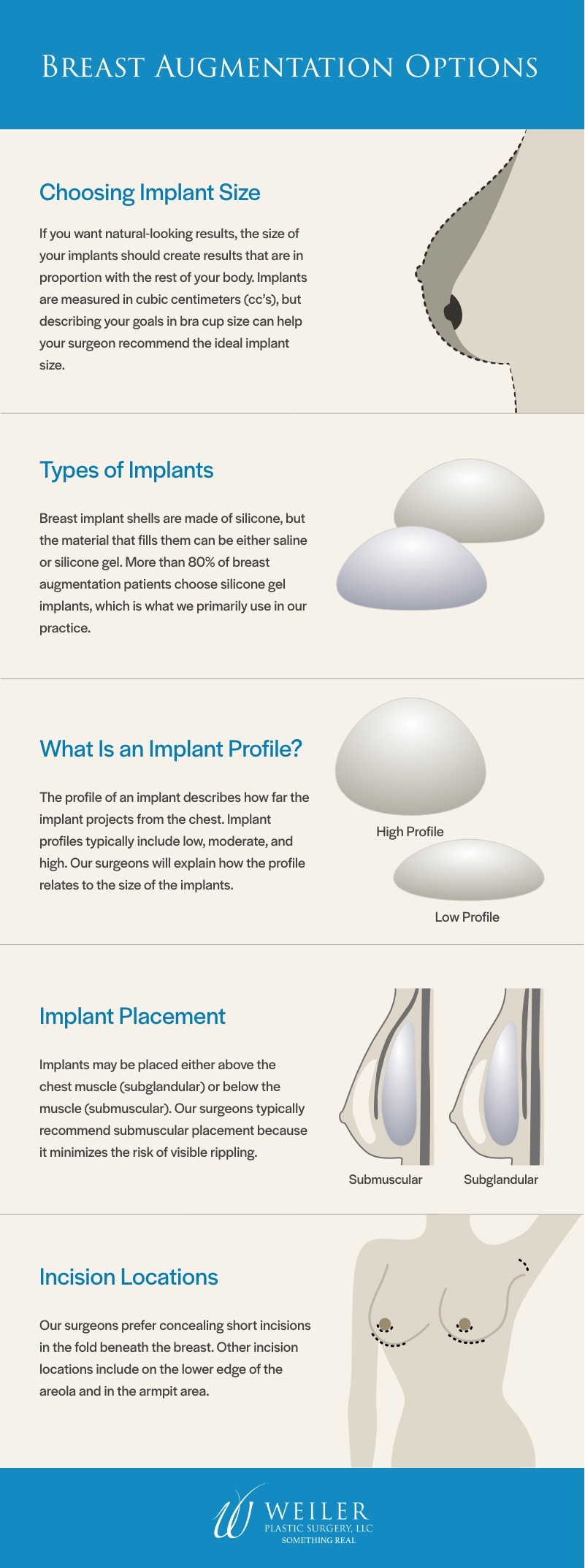 Breast Augmentation: What Types of Breast Implants Are There? – Weiler  Plastic Surgery