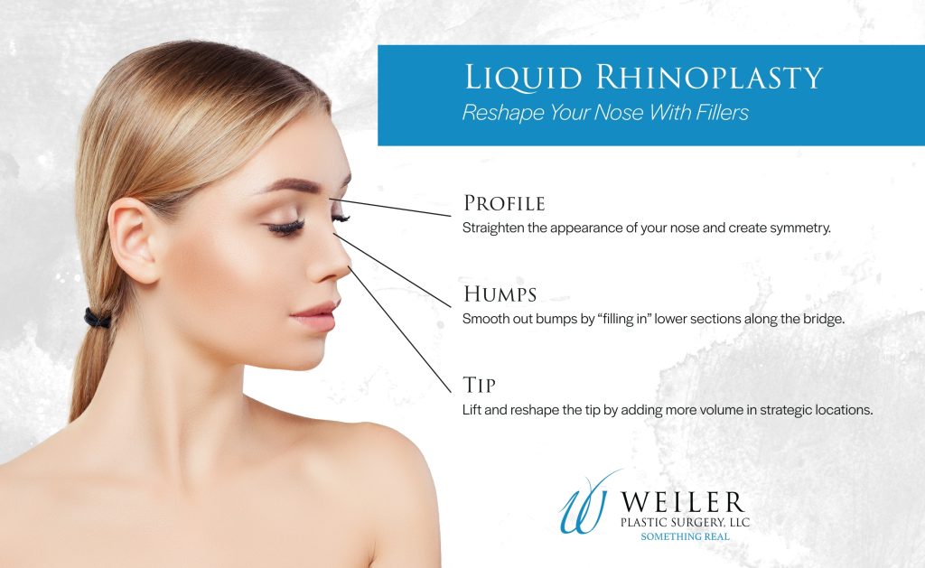 Infographic: Nonsurgical Rhinoplasty