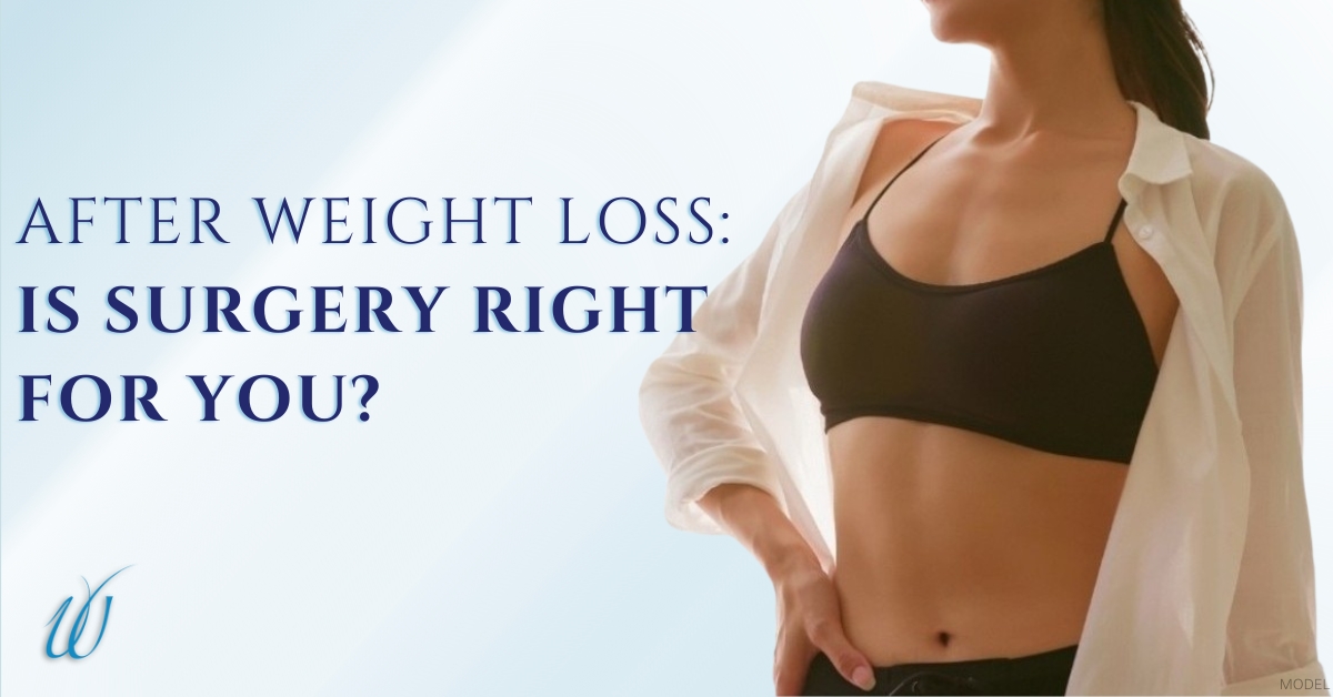 Woman wearing a black sports bra top (model) After Weight Loss: Is Surgery Right for You?